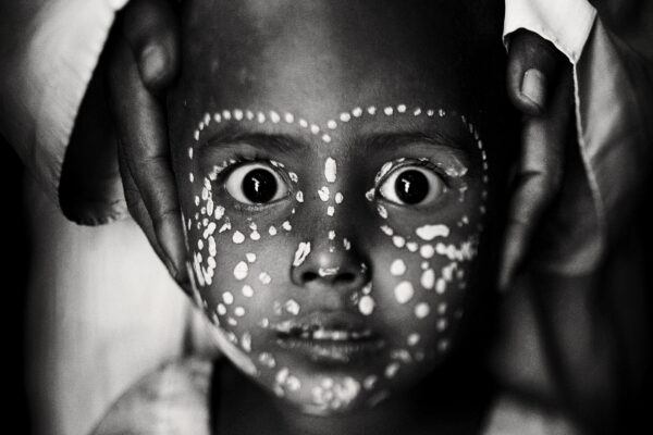 Black and White portrait of young Rohingya refugee in Myanmar by Javier Arcenillas