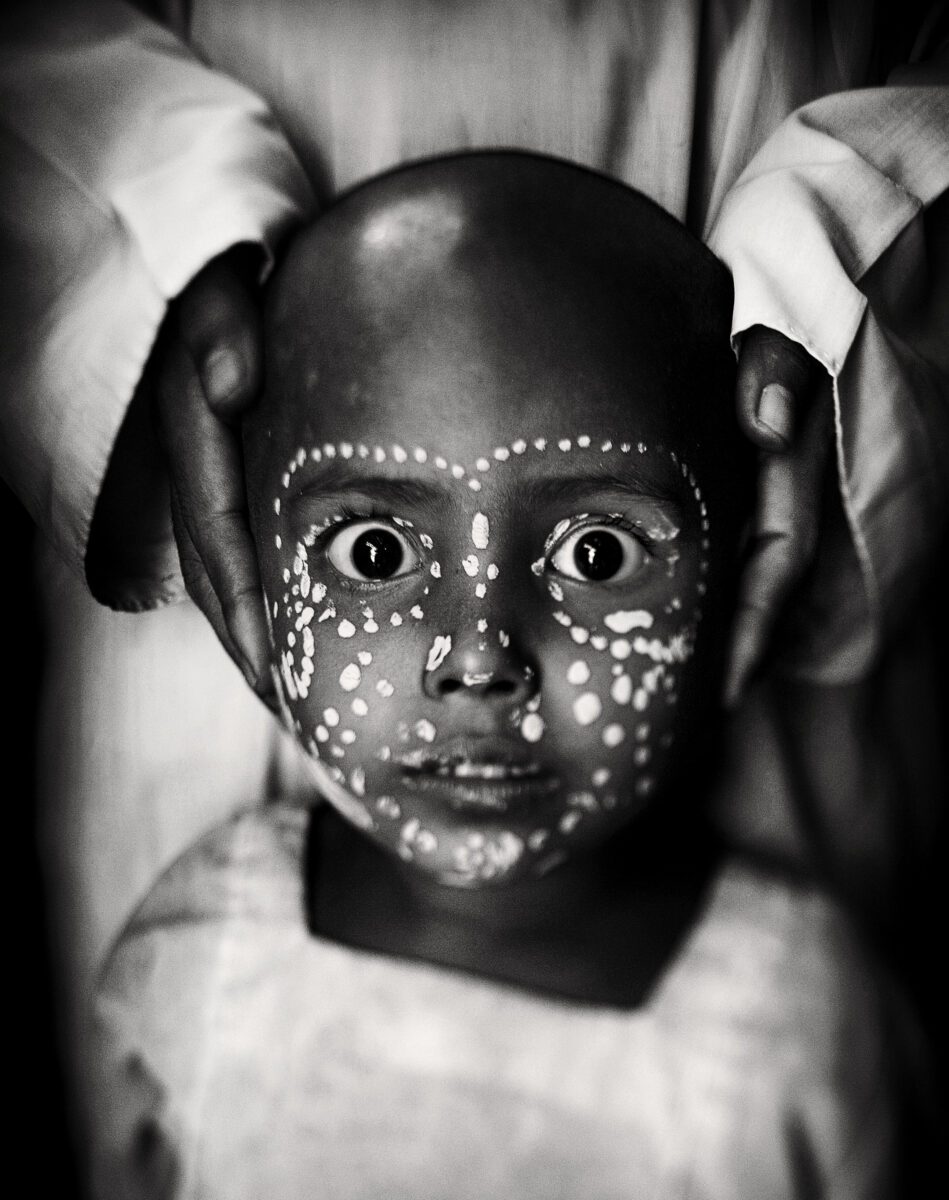 Black and White portrait of young Rohingya refugee in Myanmar by Javier Arcenillas