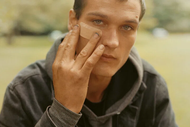 Documentary photography by Gregory Halpern. Portrait of a young man holding a plaster on his face
